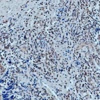 POU2F1 / OCT1 Antibody