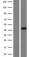L2HGDH Protein (Over-Expression Lysate Myc-DDK (Flag))