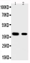 KLF5 / BTEB2 Antibody (aa109-126)