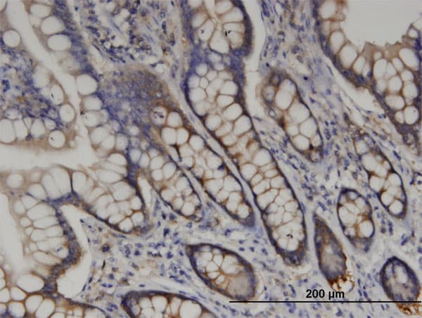 RARS Antibody (clone 1A2)