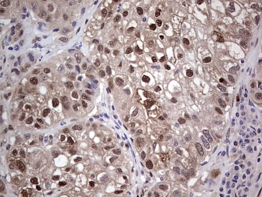 PTGS2 / COX2 / COX-2 Antibody (aa18-260, clone OTI10H5)
