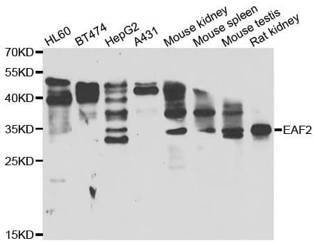 EAF2 / U19 Antibody