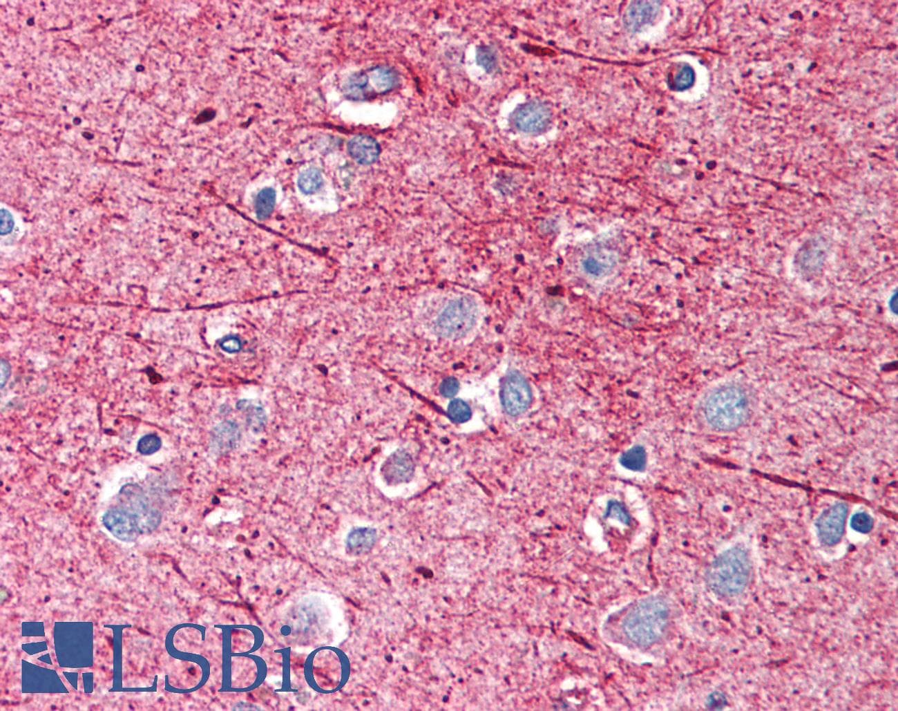 PathPlus™ Polyclonal Rabbit anti-Human CAMK2A / CaMKII Alpha Antibody (N-Terminus, IHC, WB)