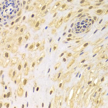 Polyclonal Rabbit anti-Human AIFM1 / AIF / PDCD8 Antibody (IHC, IF, WB)