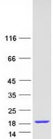 Human NHP2L1 Protein (Recombinant Myc-DDK (Flag))