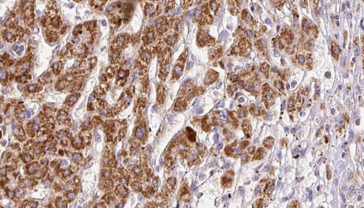 PNPLA2 / ATGL Antibody