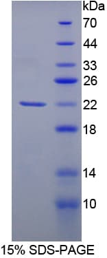 Human RASGRF1 / CDC25 Protein (Recombinant His-T7)
