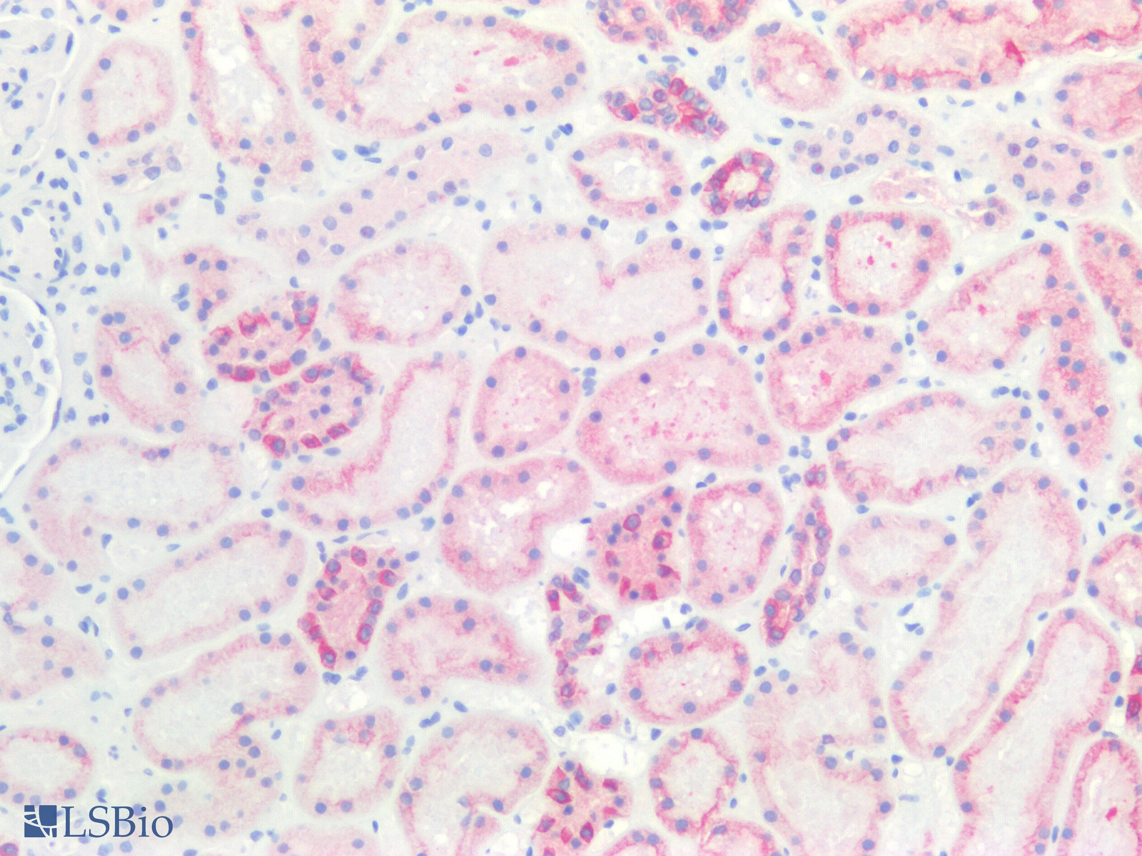 PathPlus™ KRT18 / CK18 / Cytokeratin 18 Antibody