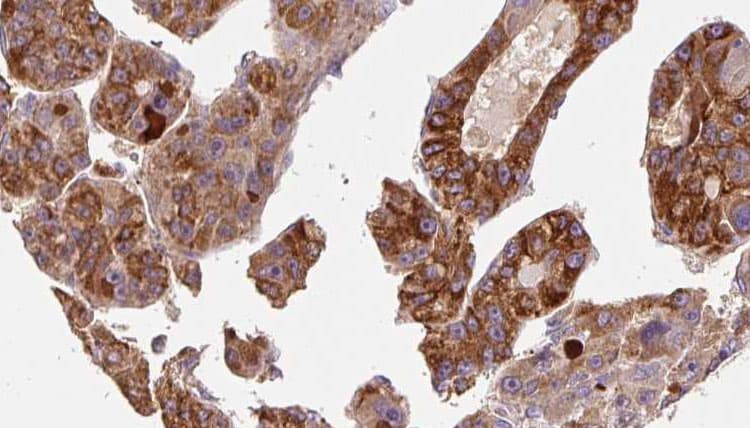 P2RY6 / P2Y6 Antibody