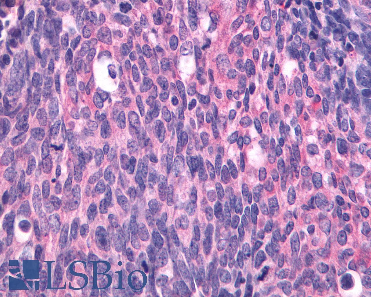 IHC-plus™ SIPR3 / EDG3 / S1P3 Antibody (C-Terminus)