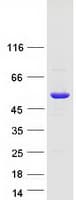Human WDR12 Protein (Recombinant Myc-DDK (Flag))