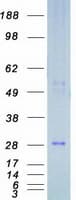 Human DIRAS3 / ARHI Protein (Recombinant Myc-DDK (Flag))