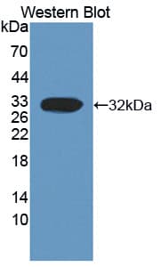 CAPN3 / Calpain 3 Antibody (aa602-821)
