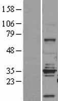 STEAP1 / STEAP Protein (Over-Expression Lysate Myc-DDK (Flag))