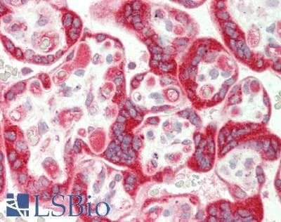TRIP10 / CIP4 Antibody (aa135-184)