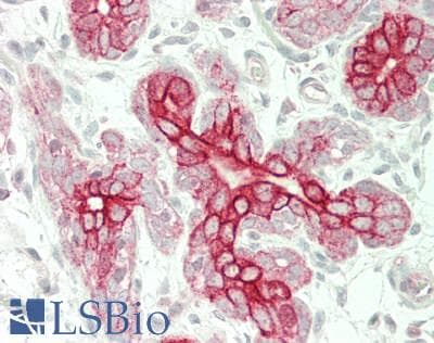 IHC-plus™ Polyclonal Rabbit anti-Human SHANK2 / SHANK Antibody (aa322-371, IHC, WB)