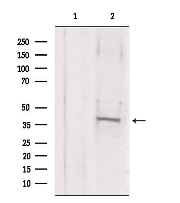 MAT2B Antibody