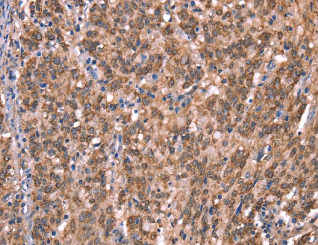 GCET2 / HGAL Antibody