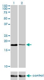 BIRC5 / Survivin Antibody (clone 5B10)