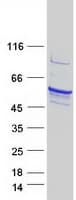 Human TPH1 / Tryptophan Hydroxylase Protein (Recombinant Myc-DDK (Flag))