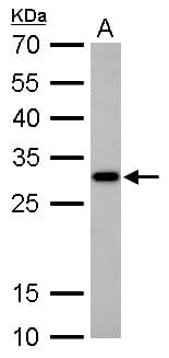CTDSP2 Antibody (aa26-271)