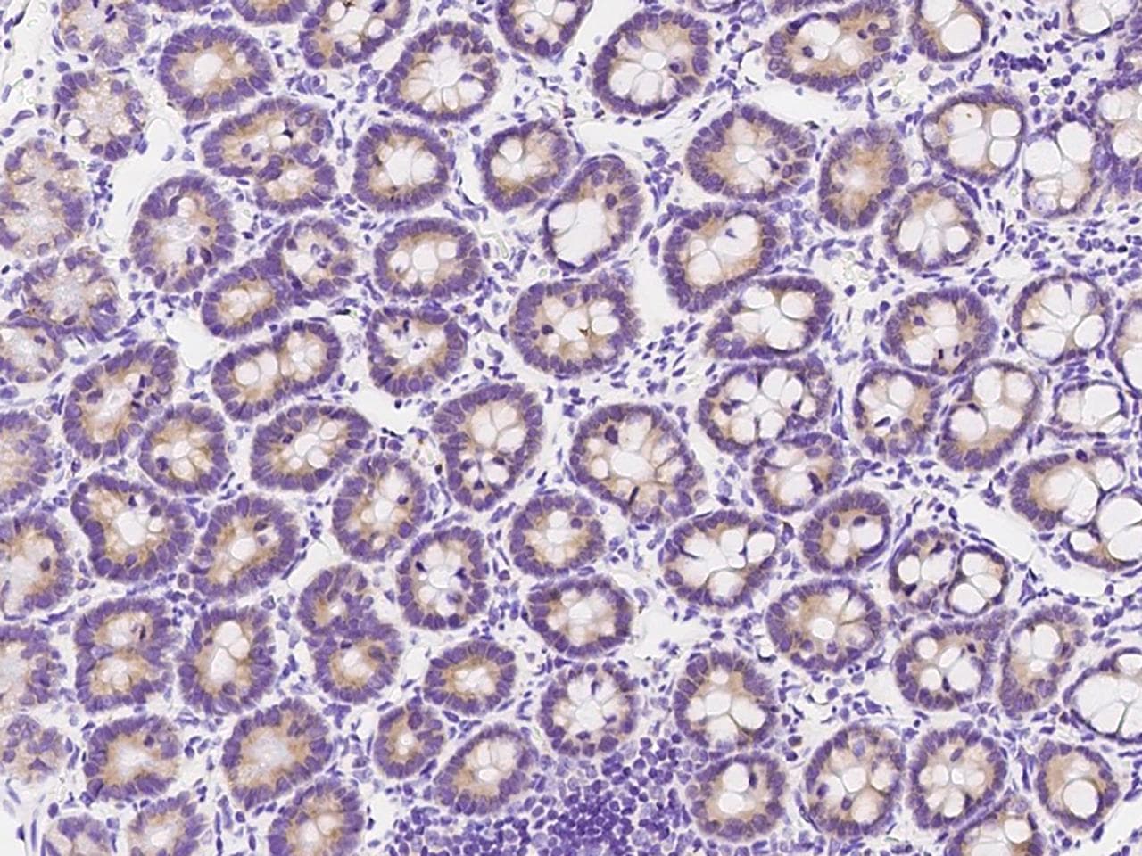 METAP2 Antibody (Preservative Free)