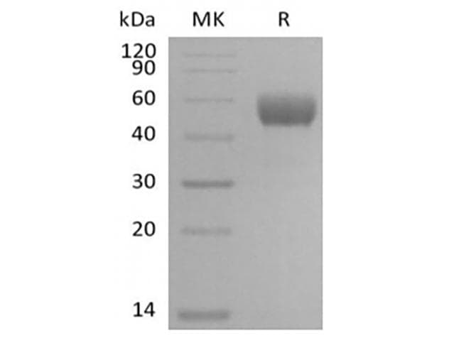 Mouse Gb:x54870_rna1 Nkg2-d Type II Integral Membrane Protein (HUMAN);contains Alu Repetitive Element;contains Element Mer33 Repetitive Element ; (Recombinant Fc, N-terminus)