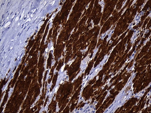 NAT1 / AAC1 Antibody (clone OTI6D7)