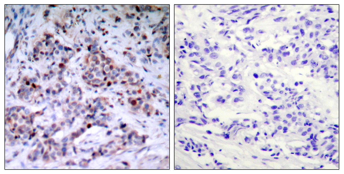 RELA / NFKB p65 Antibody (phospho-Thr435)