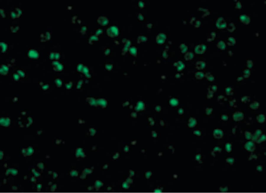 IHC-plus™ Hamartin / TSC1 Antibody