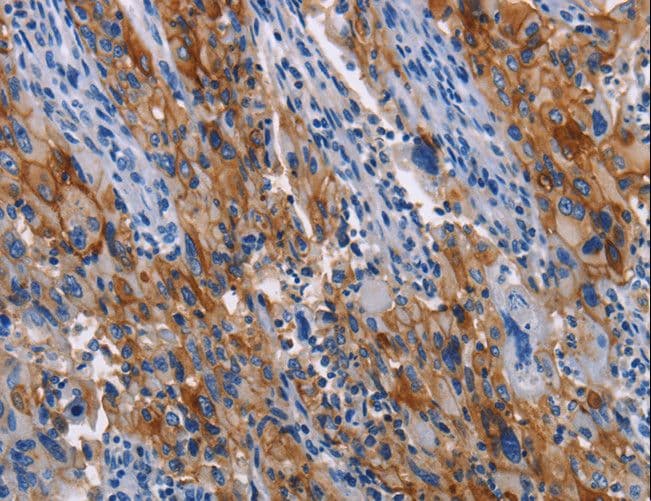 ICAM-1 / CD54 Antibody