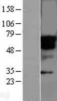 STK33 Protein (Over-Expression Lysate Myc-DDK (Flag))
