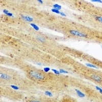 AKR7A2 / AFAR Antibody