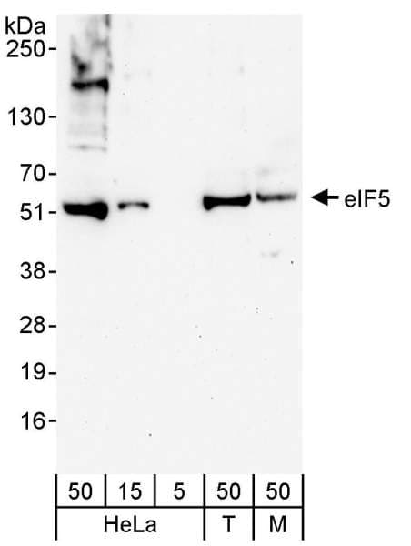 Polyclonal Rabbit anti-Human EIF5 Antibody (aa100-150, WB)