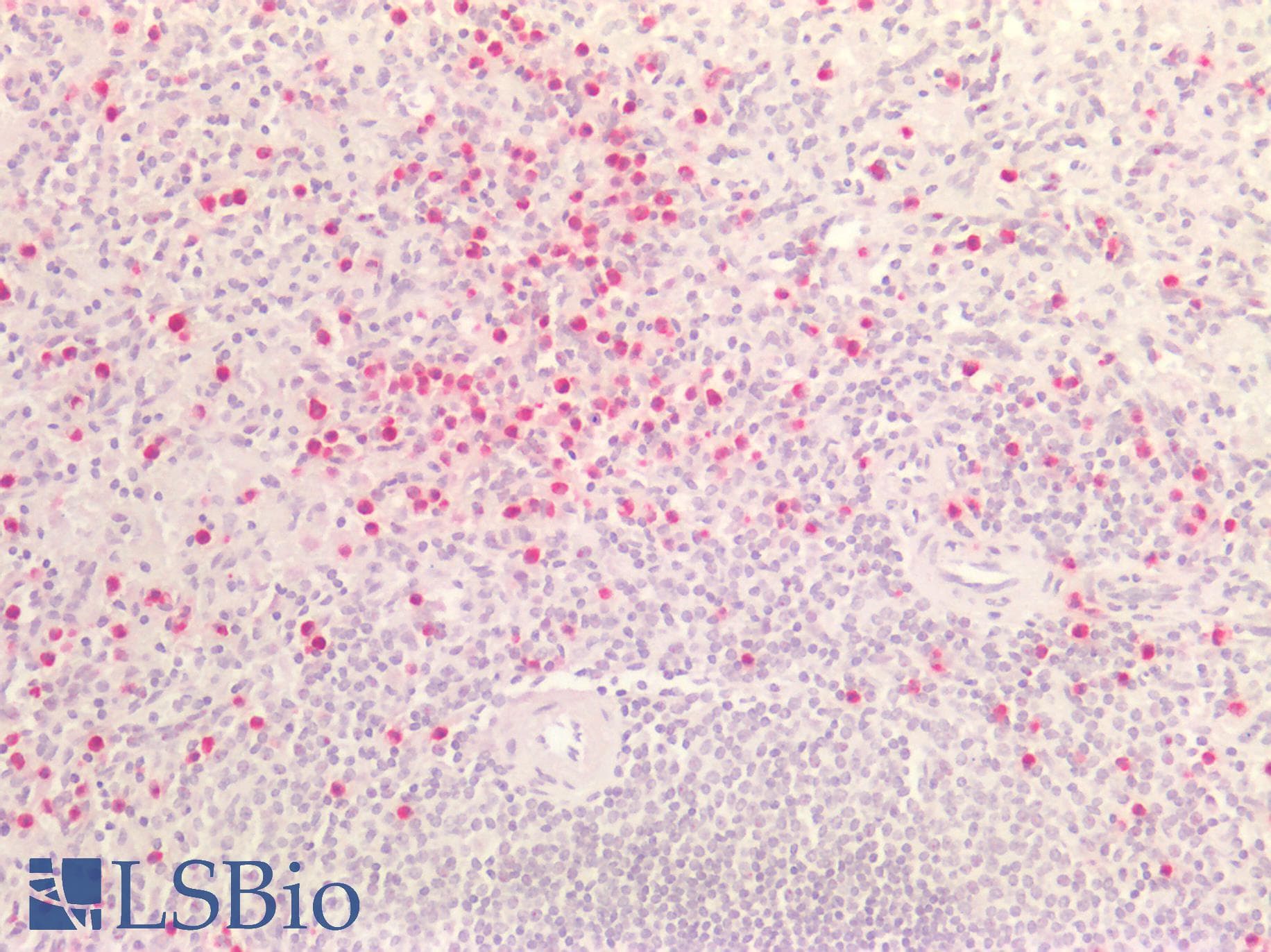 PathPlus™ HNE / Neutrophil Elastase Antibody
