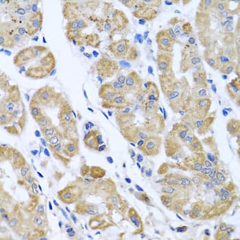 EIF2S3 / EIF2G Antibody