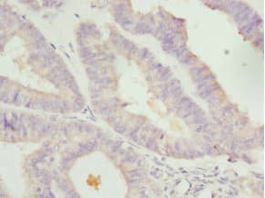 Polyclonal Rabbit anti-Human TGFB4 / LEFTY2 Antibody (IHC, WB)