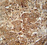 APCS / Serum Amyloid P / SAP Antibody (aa151-178)