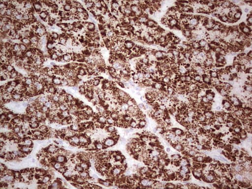 ABAT Antibody (aa29-323, clone OTI3D2)