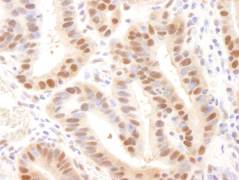 Polyclonal Rabbit anti-Human UBE2A Antibody (N-Terminus, IHC)