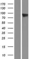 ADAM8 Protein (Over-Expression Lysate Myc-DDK (Flag))