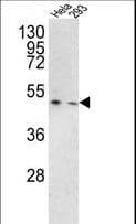 TMPRSS3 Antibody (aa272-300)