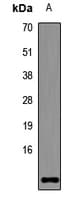 Polyclonal Rabbit anti-Human STRA13 Antibody (WB)