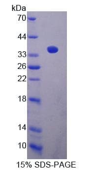 Mouse CABIN1 Protein (Recombinant His-T7)