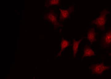 DOK1 Antibody (phospho-Tyr398)
