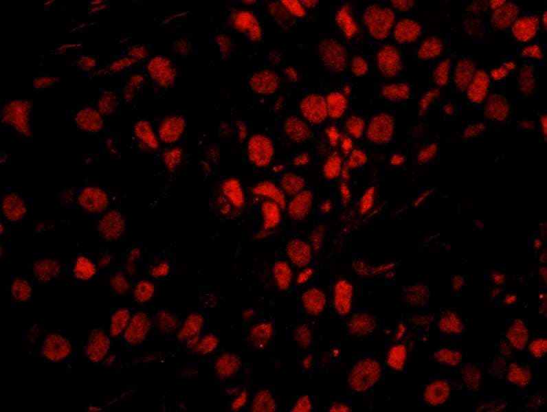 Polyclonal Rabbit anti-Human SMEK1 Antibody (aa770-C-term, IHC, IF)
