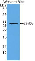 TTN / Titin Antibody (clone C1)