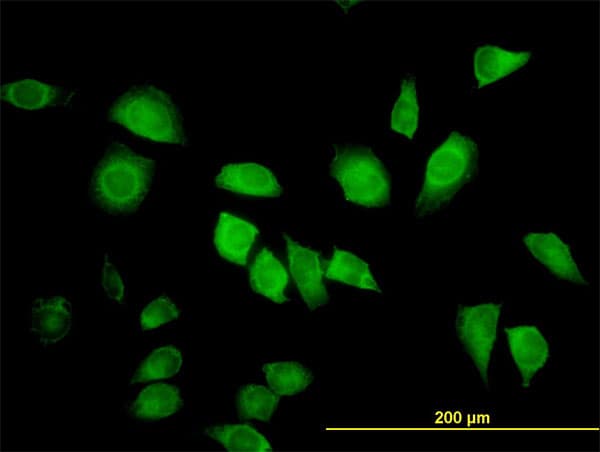 LZTFL1 Antibody (clone 7F6)