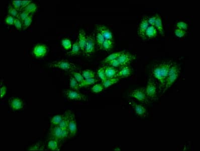 IHC-plus™ CTNNB1 / Beta Catenin Antibody