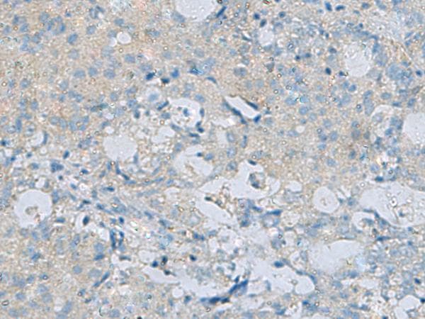 CDH12 / Cadherin 12 Antibody